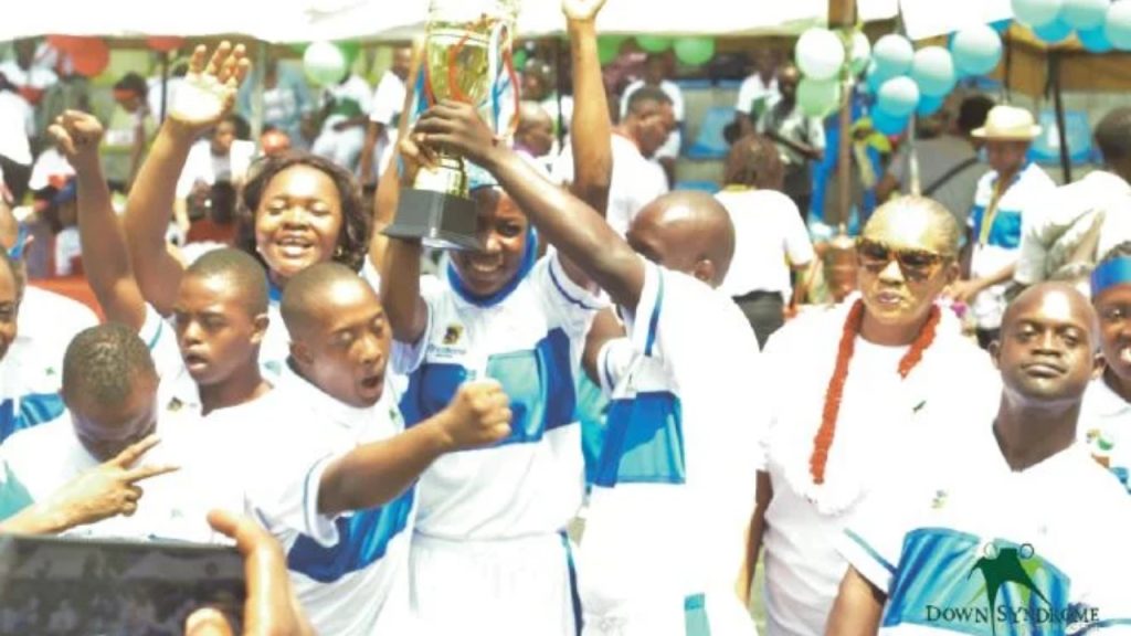 File photo: Down Syndrome